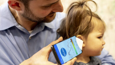 A Smartphone App And A Paper Funnel Could Help Parents Diagnose Kids' Ear Infections 9 Dr. Randall Bly, an assistant professor of otolaryngology-head and neck surgery at the University of Washington School of Medicine who practices at Seattle Children's Hospital, uses the experimental smartphone app and a paper funnel to check his daughter's ear.