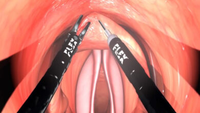 Flexible Robotic System Offers Articulated Scope for Laryngeal and Colorectal Surgery 3 411 flat aelc emca flex medrobotics cover photo site
