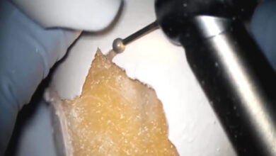 Training and Practice Makes Perfect: Entertaining Way of Learning the Basics of Sinus Lifting Surgery 2 591 flat aelc emca pr Sinus lifting on the egg.mp4 cover photo site