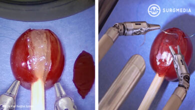 680 flat aelc emca davinci surgical system grape suturing cover photo e2