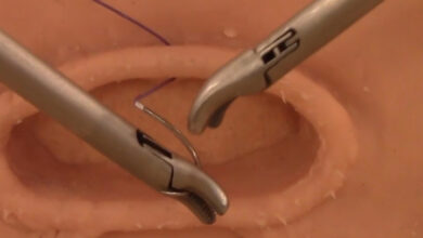 Laparoscopic Suturing and Extracorporeal Knot Tying 8 781 flat aelc emca Laparoscopic Extracorporeal Knot Tying cover photo site