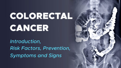 Colorectal Cancer 11 Colorectal Cancer Introduction, Risk Factors, Prevention, Symptoms and Signs