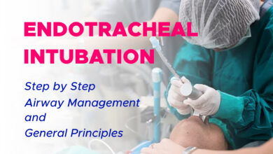 Step by Step Endotracheal Intubation 6 Step by Step Endotracheal Intubation Airway Management and General Principles