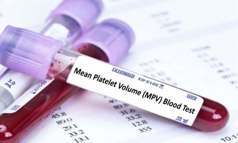 high mpv low platelet count