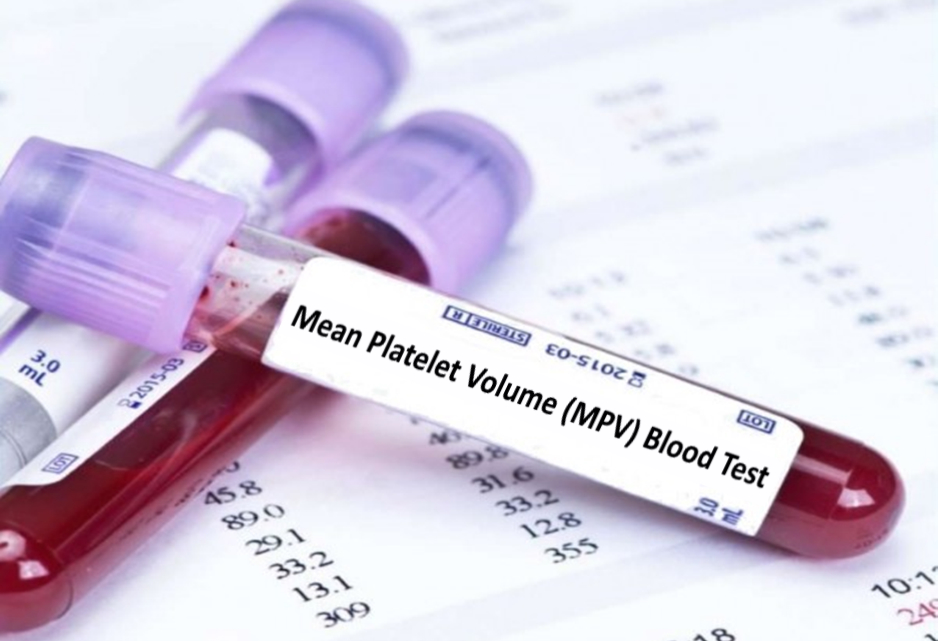 high mpv blood test