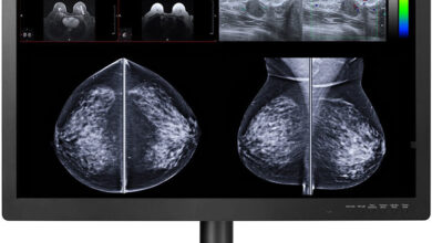 Cutting-Edge 31-inch 12 Megapixel Display Solutions for PACS and Breast Imaging FDA Cleared 6 Cutting-Edge 31-inch 12 Megapixel Display Solutions for PACS and Breast Imaging FDA Cleared