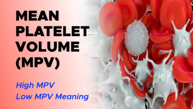 Understanding Mean Platelet Volume (MPV) Blood Test: High MPV, Low MPV Meaning 2 Understanding Mean Platelet Volume (MPV) Blood Test: High MPV, Low MPV Meaning