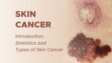 Skin Cancer: Introduction, Statistics and Types of Skin Cancer 2 Skin Cancer: Introduction, Statistics and Types of Skin Cancer