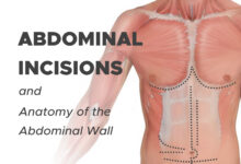 Types of Abdominal Incisions: Midline, Paramedian, Transverse and Oblique Incisions