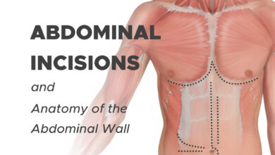 Abdominal Incisions and Anatomy of the Abdominal Wall 25 Types of Abdominal Incisions: Midline, Paramedian, Transverse and Oblique Incisions