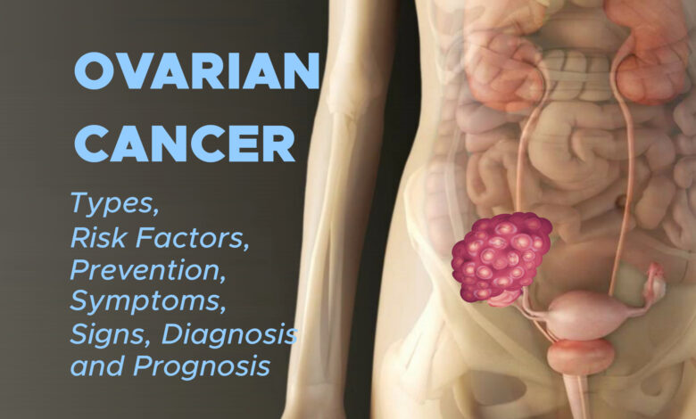 Ovarian Cancer Types Risk Factors Prevention Symptoms Signs 