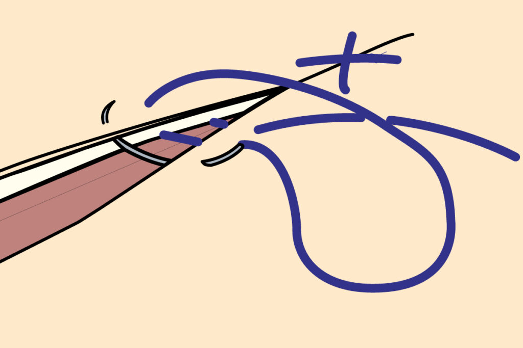 Common Suture Patterns SurgMedia