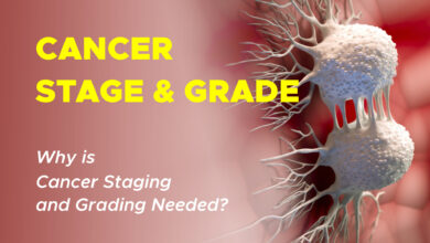 What is the Difference Between Cancer Grade and Cancer Stage? 8 Cancer Grade vs. Cancer Stage