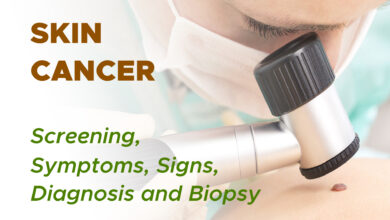 Non Melanoma Skin Cancer: Screening, Symptoms, Signs, Diagnosis and Biopsy 1 Non Melanoma Skin Cancer: Screening, Symptoms, Signs, Diagnosis and Biopsy