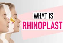 What is Rhinoplasty? 67 What is Rhinoplasty - SurgMedia